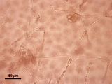 5 - Cellule stellate in visione superficiale